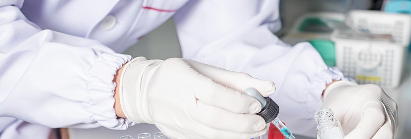 防凍液檢測(cè)