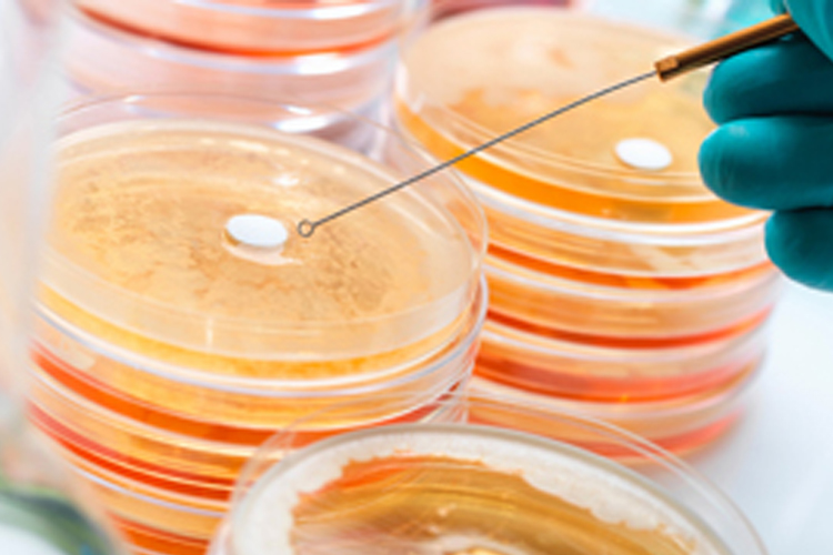 壓花輪檢測(cè)